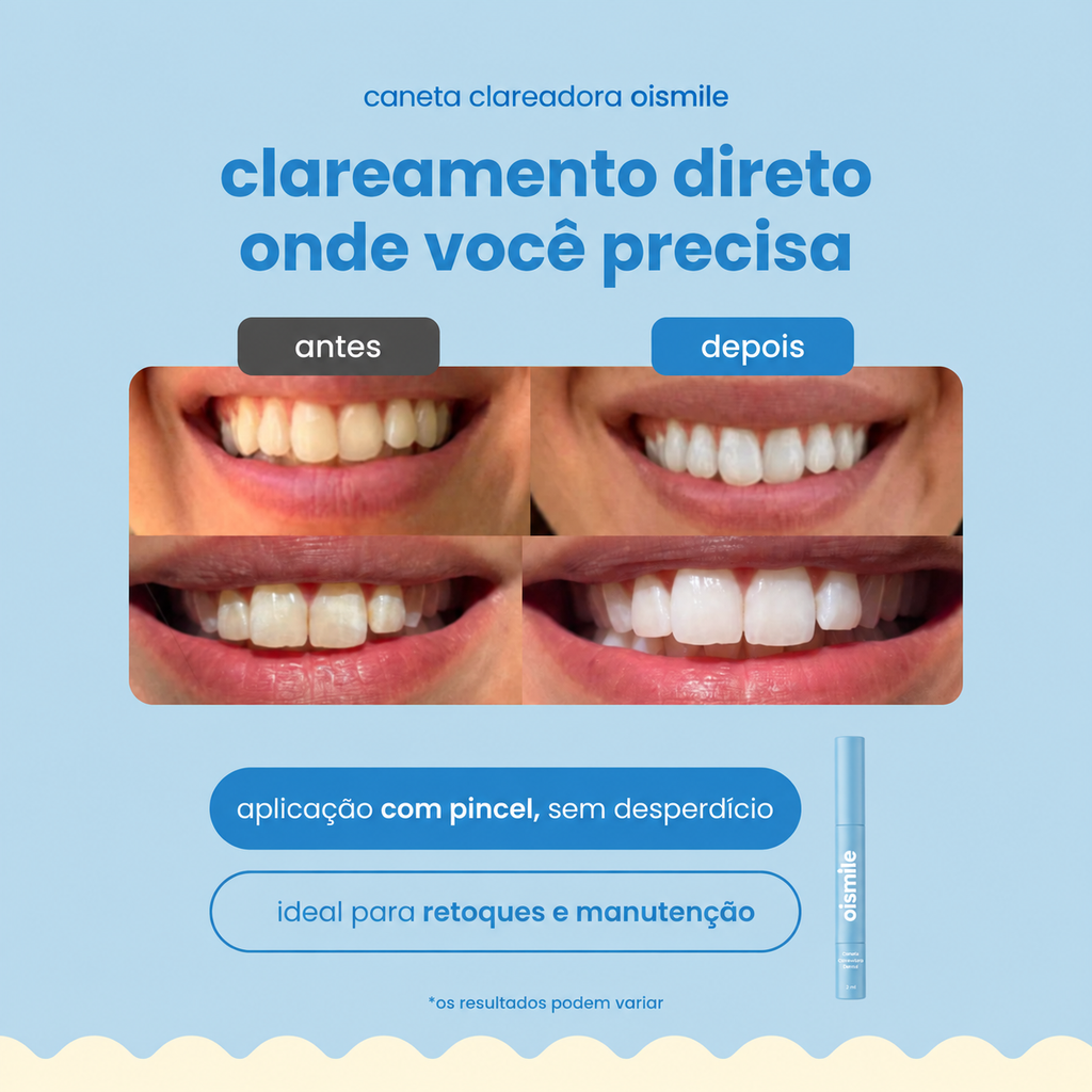 Caneta Clareadora Dental oismile